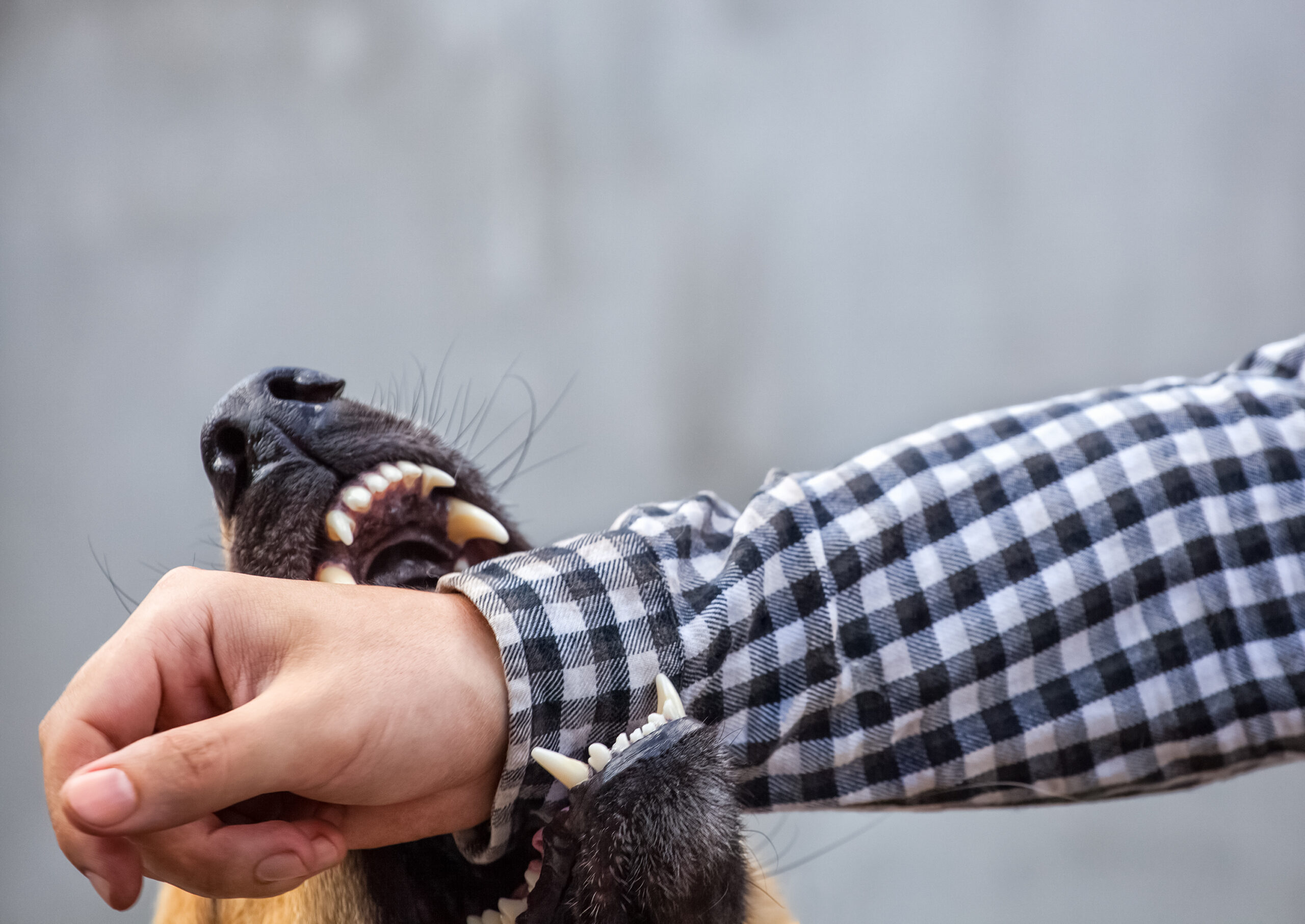 3 Types Of Infections You Can Get From Dog Bites